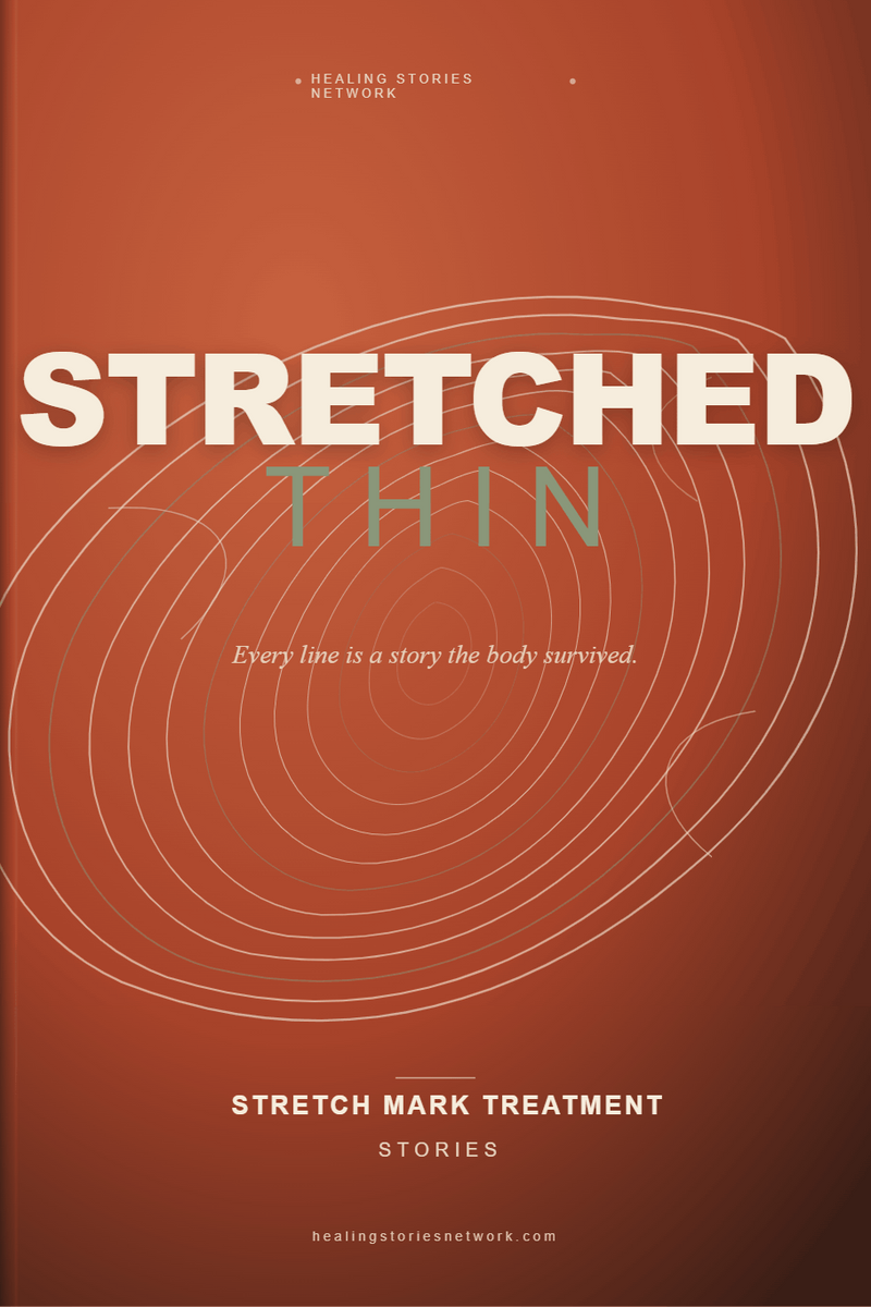 Stretched Thin: Stretch Mark Treatment Stories