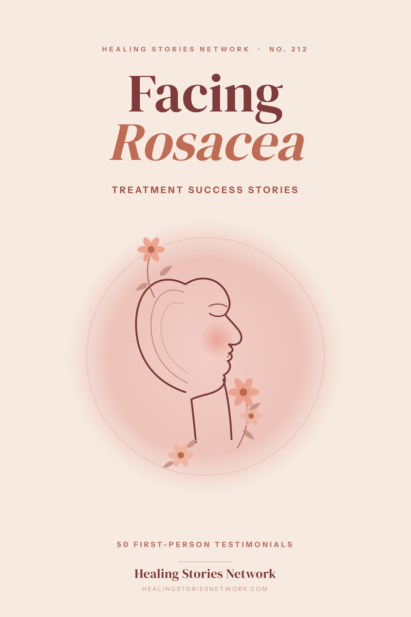 Facing Rosacea: Treatment Success Stories