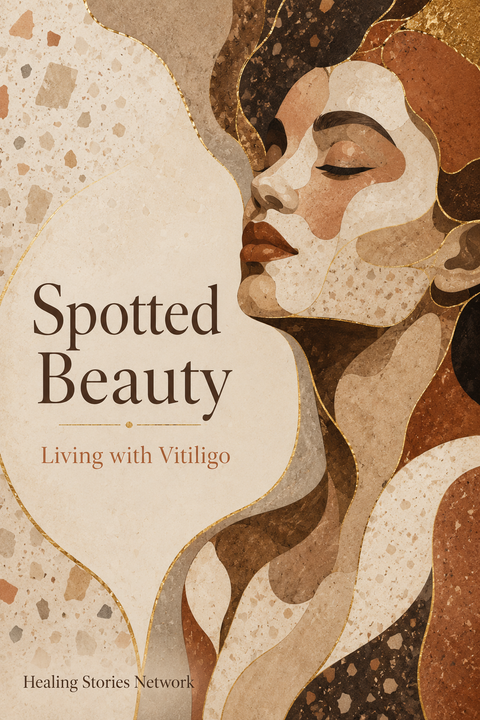 Spotted Beauty: Living with Vitiligo