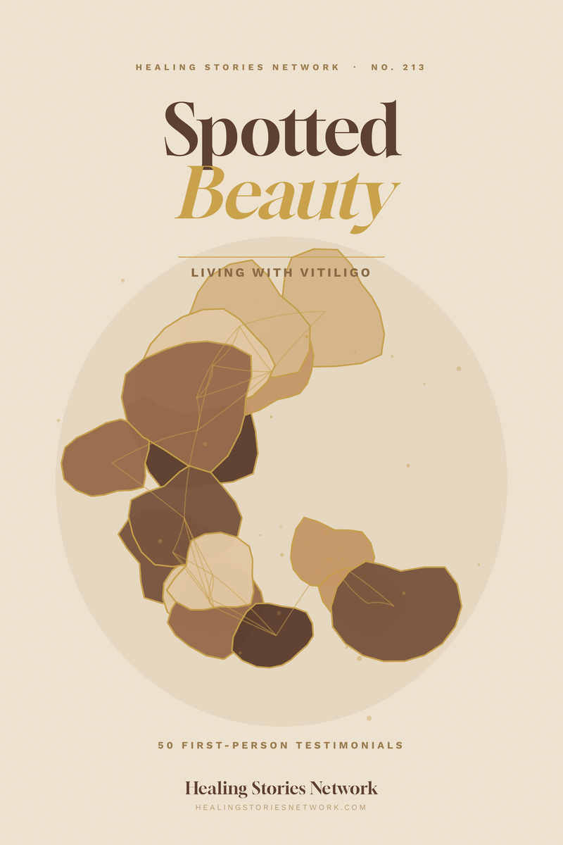Spotted Beauty: Living with Vitiligo
