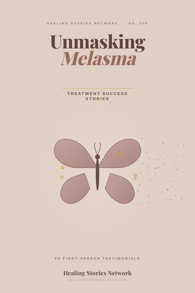 Unmasking Melasma: Treatment Success Stories