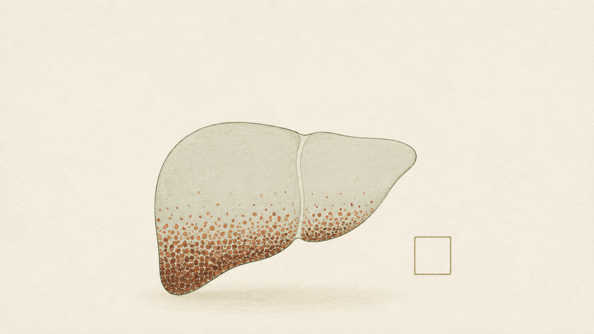 Hemochromatosis: The Common Genetic Disease Nobody Tests For