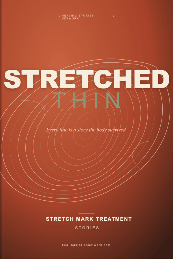 Stretched Thin: Stretch Mark Treatment Stories