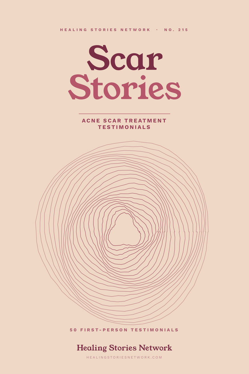 Scar Stories: Acne Scar Treatment Testimonials