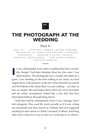 Sample page 1 from Defining Moments — a first-person Chin Implant / Genioplasty story