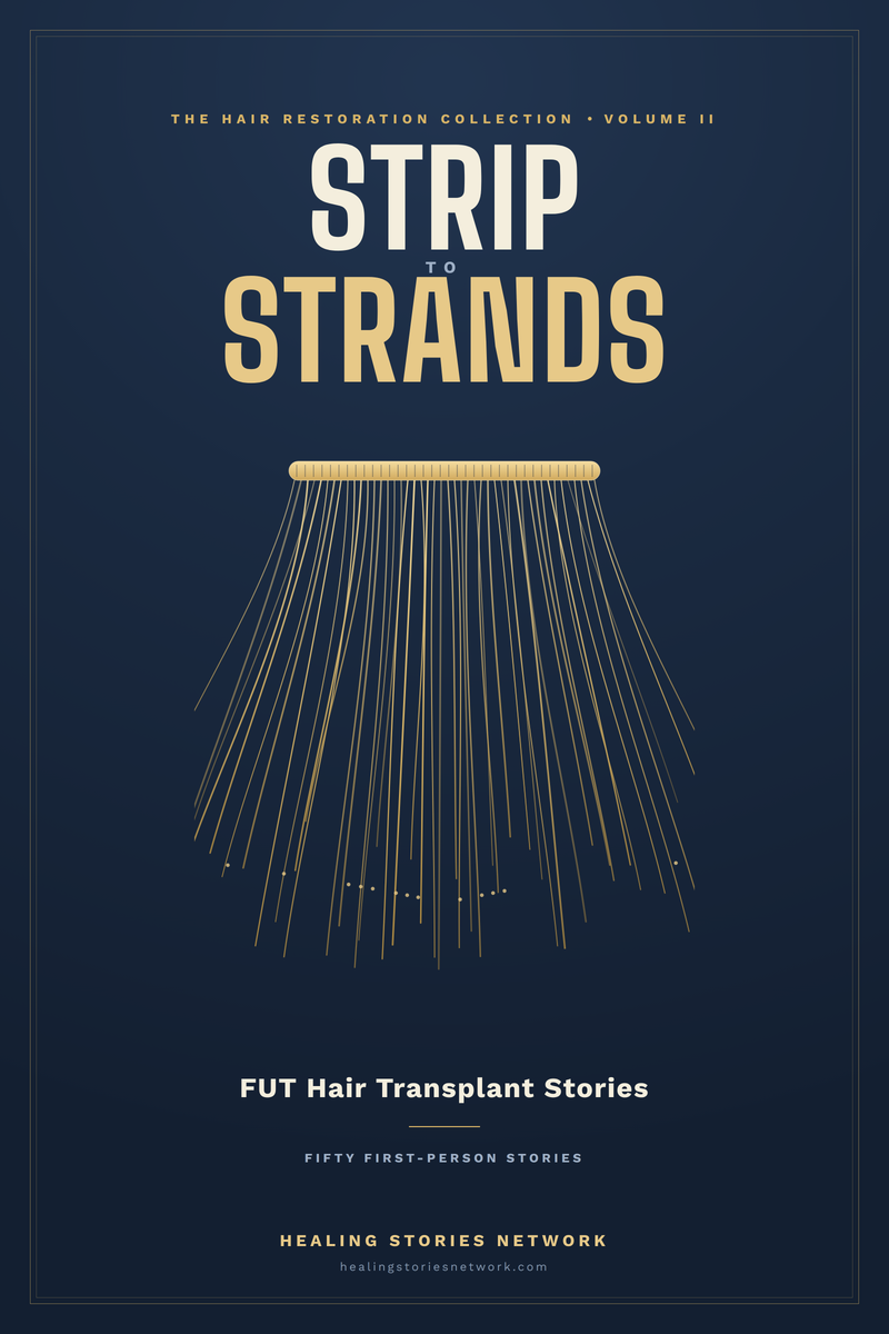 Strip to Strands: Follicular Unit Transplantation (FUT) Hair Transplant Stories