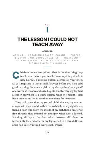 Sample page 1 from Web Free — a first-person Spider Vein Treatment story